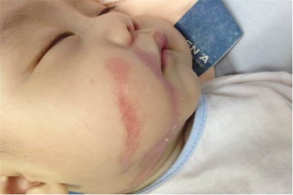 Cảnh báo - Nhầm lẫn khi dùng thuốc gây hậu quả nghiêm trọng